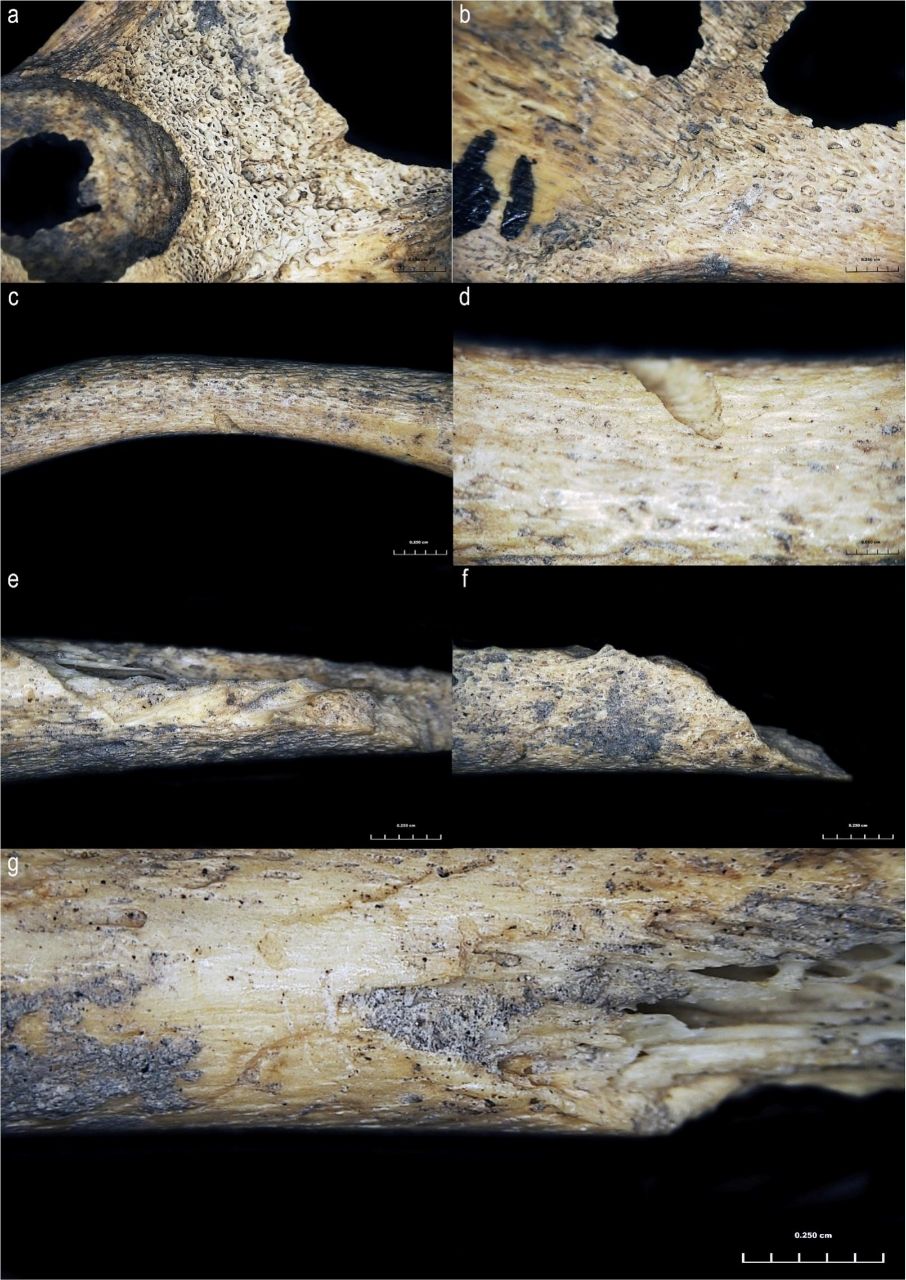 Oldest evidence of assisted birth found in 6,000-year-old newborn bones