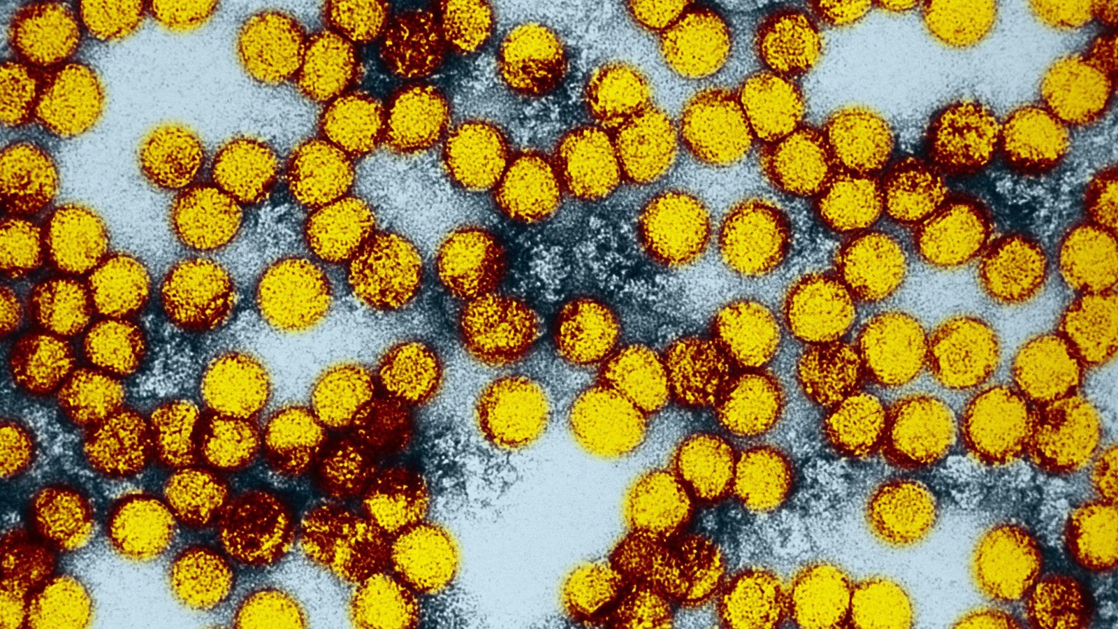 A series of yellow, spherical virus particles against a white background